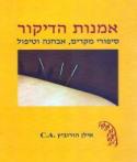 אמנות הדיקור
